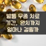 발톱 무좀 치료 기간, 완치까지 얼마나 걸릴까?