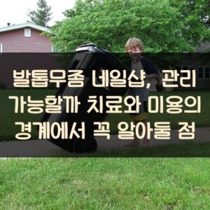 발톱무좀 네일샵, 관리 가능할까? 치료와 미용의 경계에서 꼭 알아둘 점