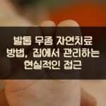 발톱 무좀 자연치료 방법, 집에서 관리하는 현실적인 접근