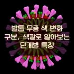 발톱 무좀 색 변화 구분, 색깔로 알아보는 단계별 특징