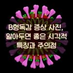 B형독감 증상 사진, 알아두면 좋은 시각적 특징과 주의점